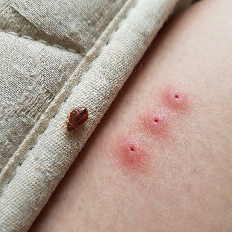 piqure punaise de lit, punaise de lit piqure